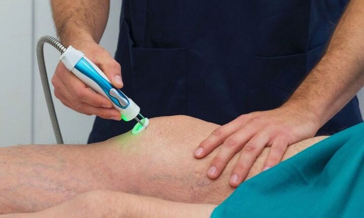 Thermographie de l'articulation du genou dans l'arthrose